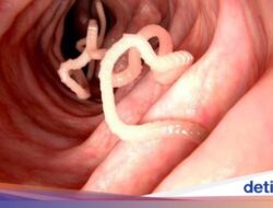 Kenali 5 Cacing dan Bakteri yang Sering ‘Bersembunyi’ Di Minuman