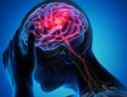 Dikira Migrain Biasa, Ternyata Wanita Ini Idap Tumor Otak Bertahun-tahun