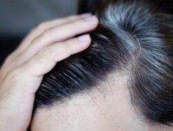 Viral Tren Suntik ‘Perawatan Uban’ Ke China, Rambut Putih Diklaim Bisa Kembali Hitam