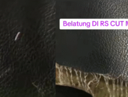 Kemenkes Tegur RSUD Cut Meutia Imbas Viral Bed Pasien Penuh Belatung