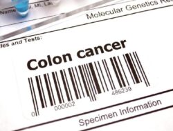 Kisah Wanita 24 Tahun Kena Kanker Usus Stadium 4, Ini Gejalanya