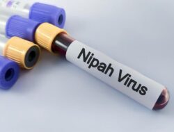 Kemenkes RI Keluarkan Edaran Waspadai Patogen Nipah usai Mewabah Di India