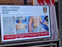 3 Ahli Kemakmuran Spesialis Tangani Aktivis KontraS Disiram Air Keras, Mata Rusak Parah