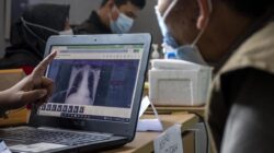 Skrining TB dan Cek Kesejaganan Gratis Digelar Untuk Warga Kawasan Karst